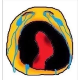 Sticker from La carita amarilla