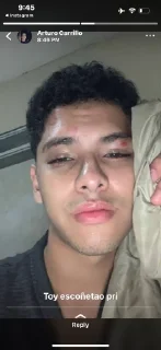 🤕 emoji lol players Telegram sticker 20 of 78