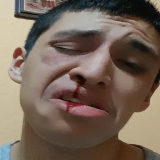 🤕 emoji Javi Telegram sticker 11 of 54