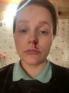 🤕 emoji Video Favorite stickers Telegram sticker 2 of 50