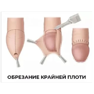 🫥 emoji ЗИП ФАЙЛ!! Telegram sticker 16 of 35