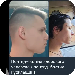 👍 emoji Расолухи Telegram sticker 3 of 60