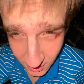 🤕 emoji течис редан / ебальники Telegram sticker 7 of 56
