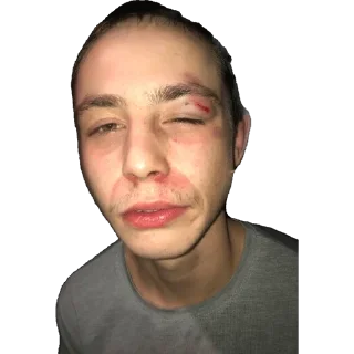 🤕 emoji Веселая Жизнь Telegram sticker 7 of 44