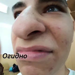 🤮 emoji Дурдом Telegram sticker 21 of 33