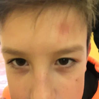 🤕 emoji ДИКИЙ ДЭНС Telegram sticker 13 of 73