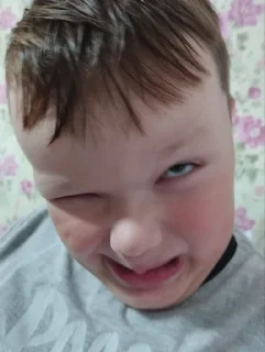 Дебил