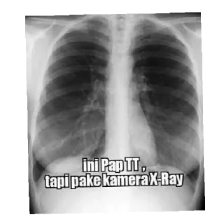 Sticker from Tete gede